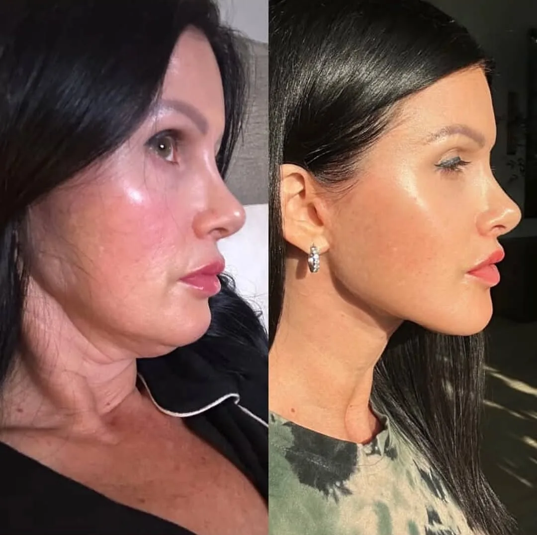 Before and after — Dr. Randy Sanovich