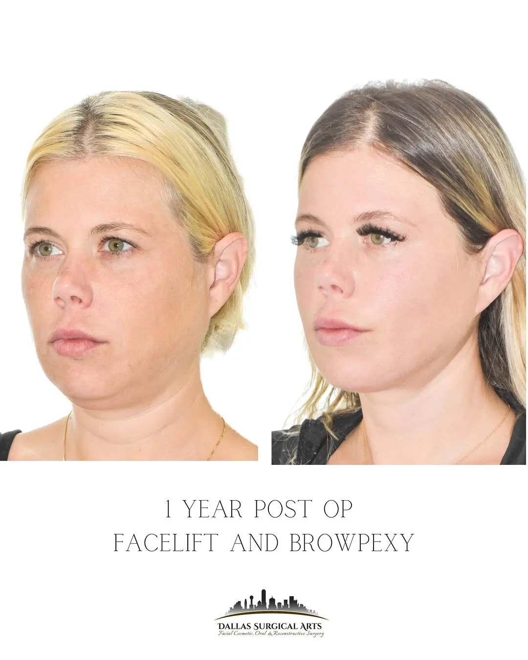 Before and after — Dr. Randy Sanovich