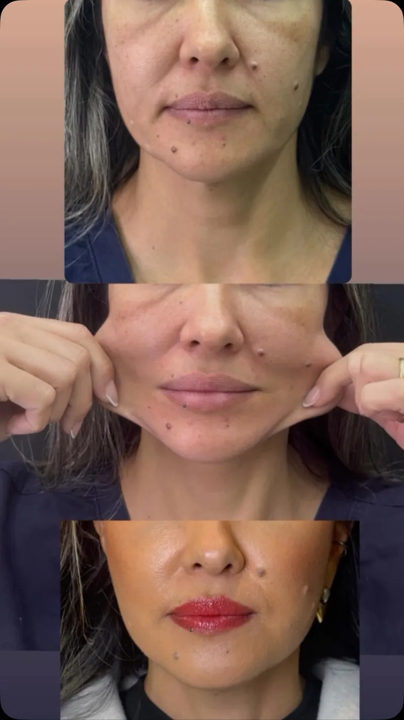 Before and after — Dr. Raphael Alves