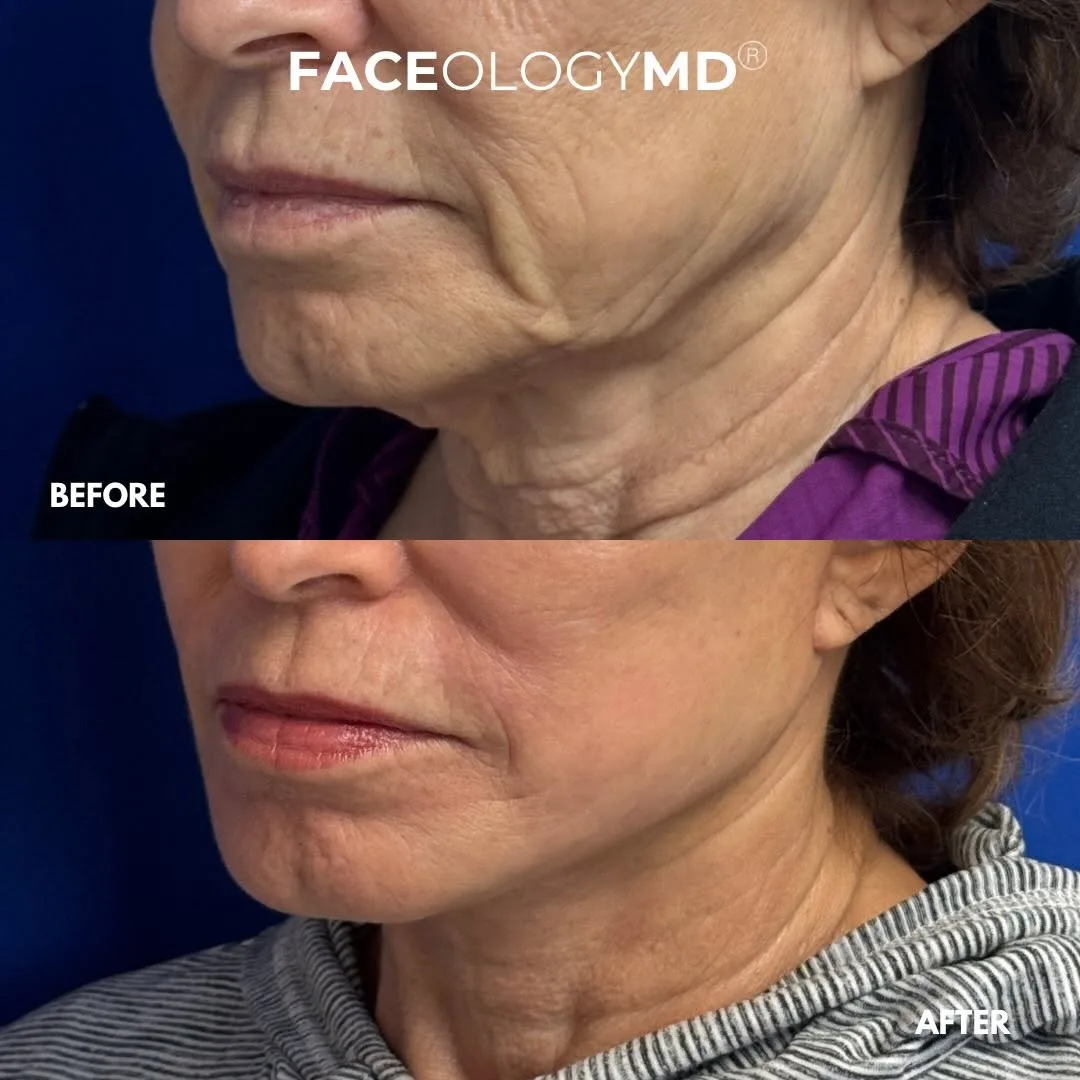 Before and after — Dr. Raymond Lee