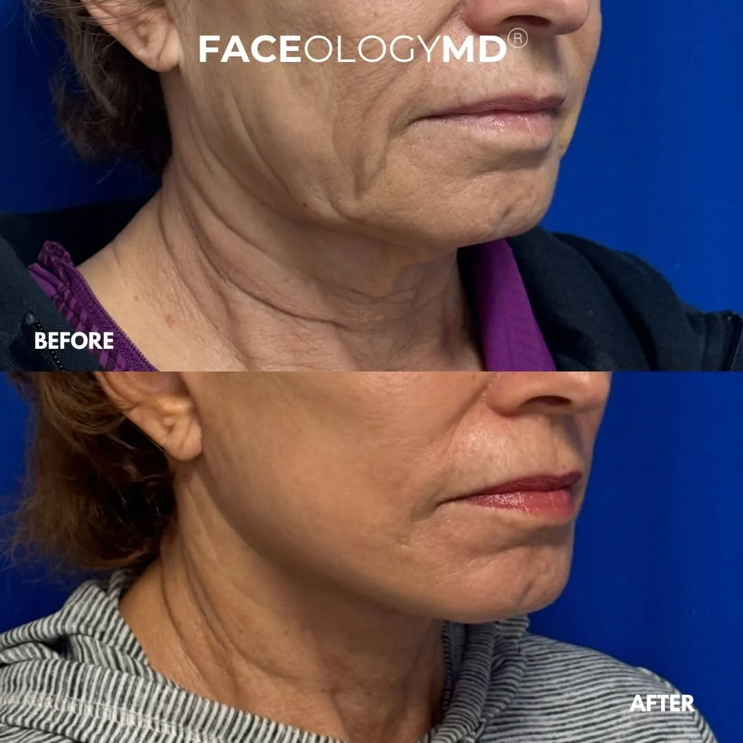 Before and after — Dr. Raymond Lee