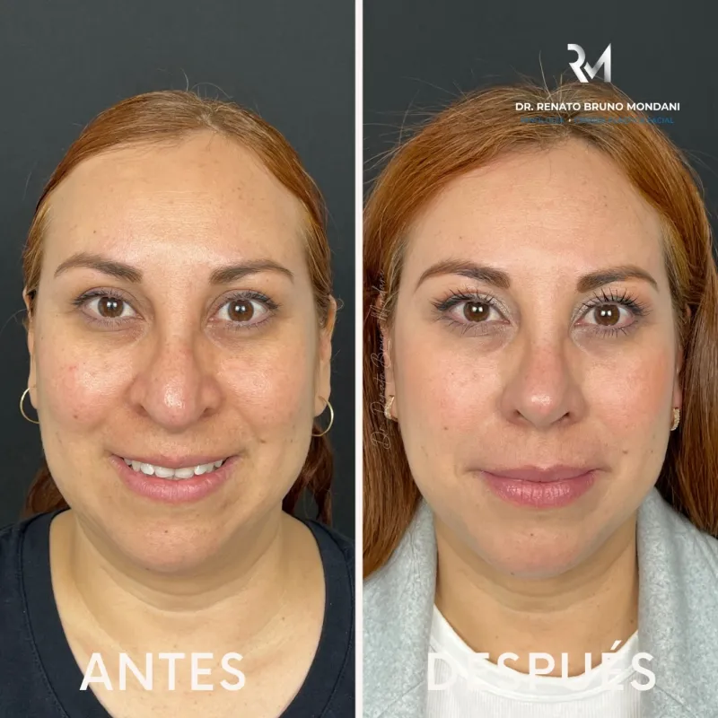 Before and after: Dr. Renato Bruno Mondani
