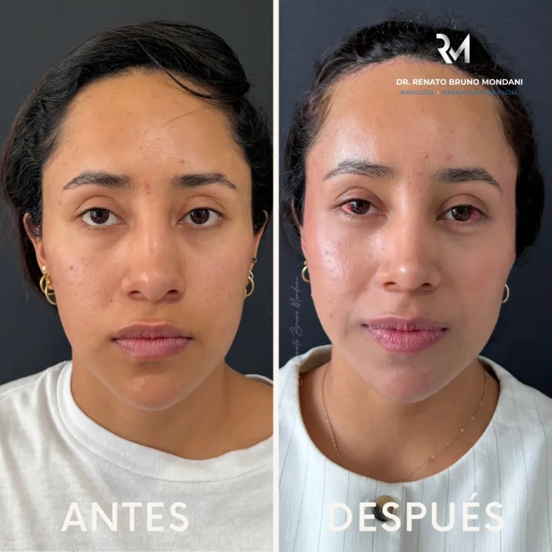 Before and after: Dr. Renato Bruno Mondani