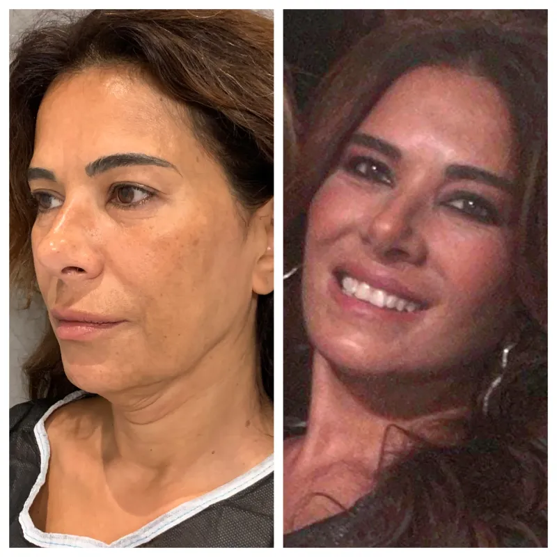 Before and after: Dr. Renato Calabria