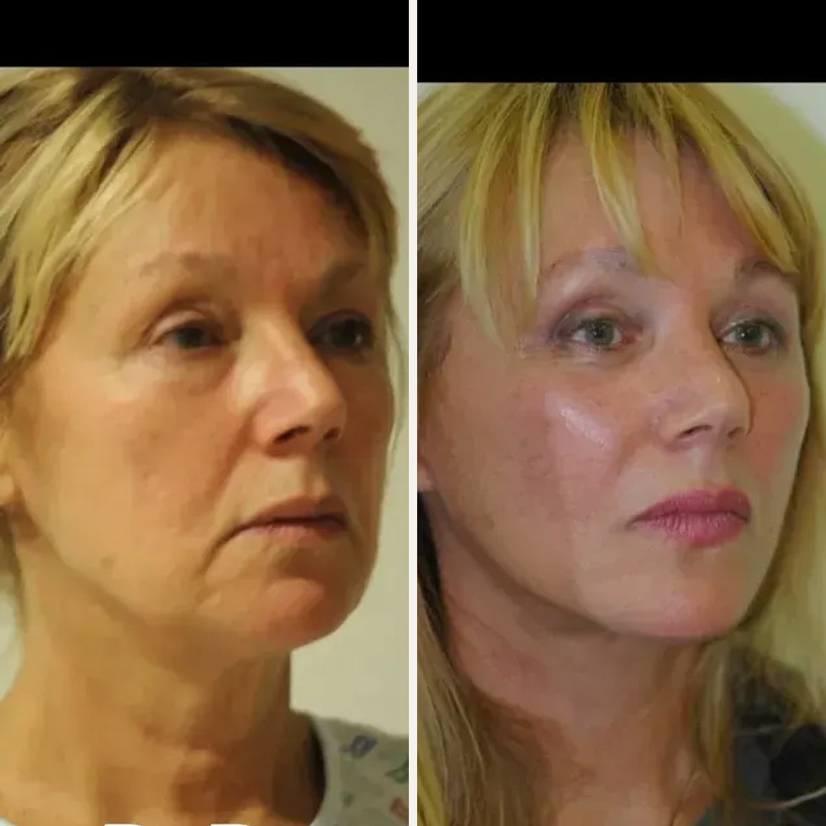 Before and after: Dr. Renato Calabria