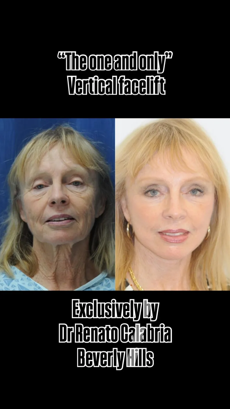 Before and after: Dr. Renato Calabria