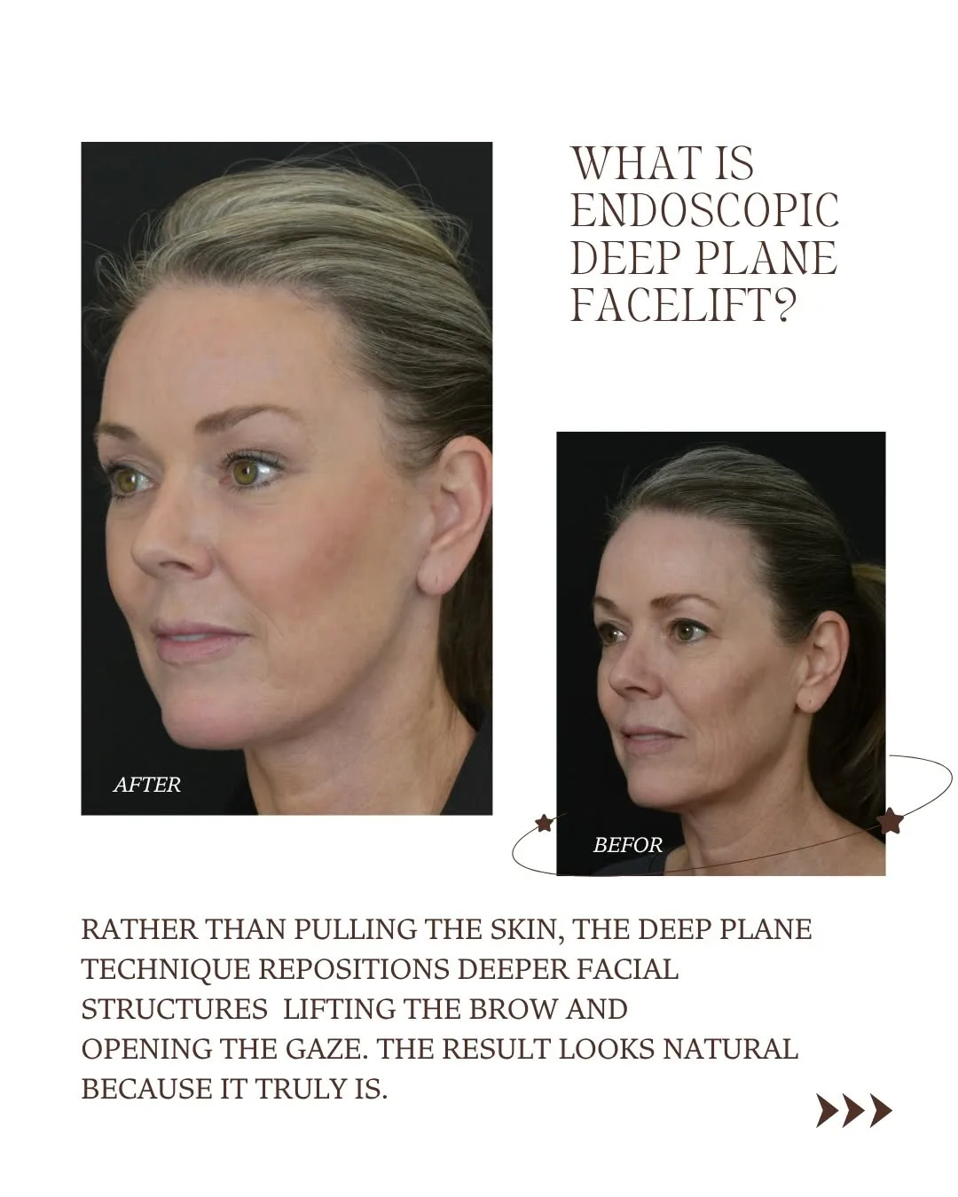 Before and after — Dr. Renato Saltz