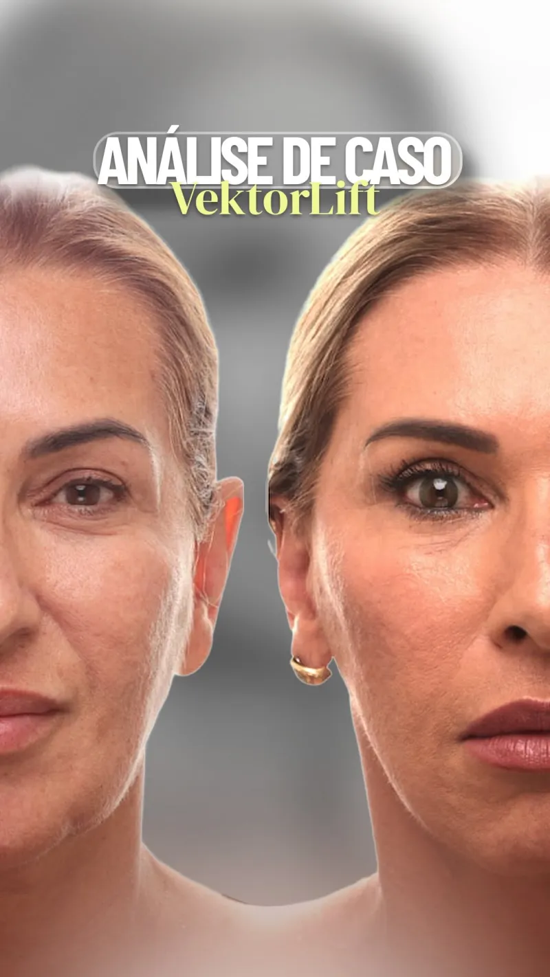 Before and after: Dr. Ricardo Kacowicz