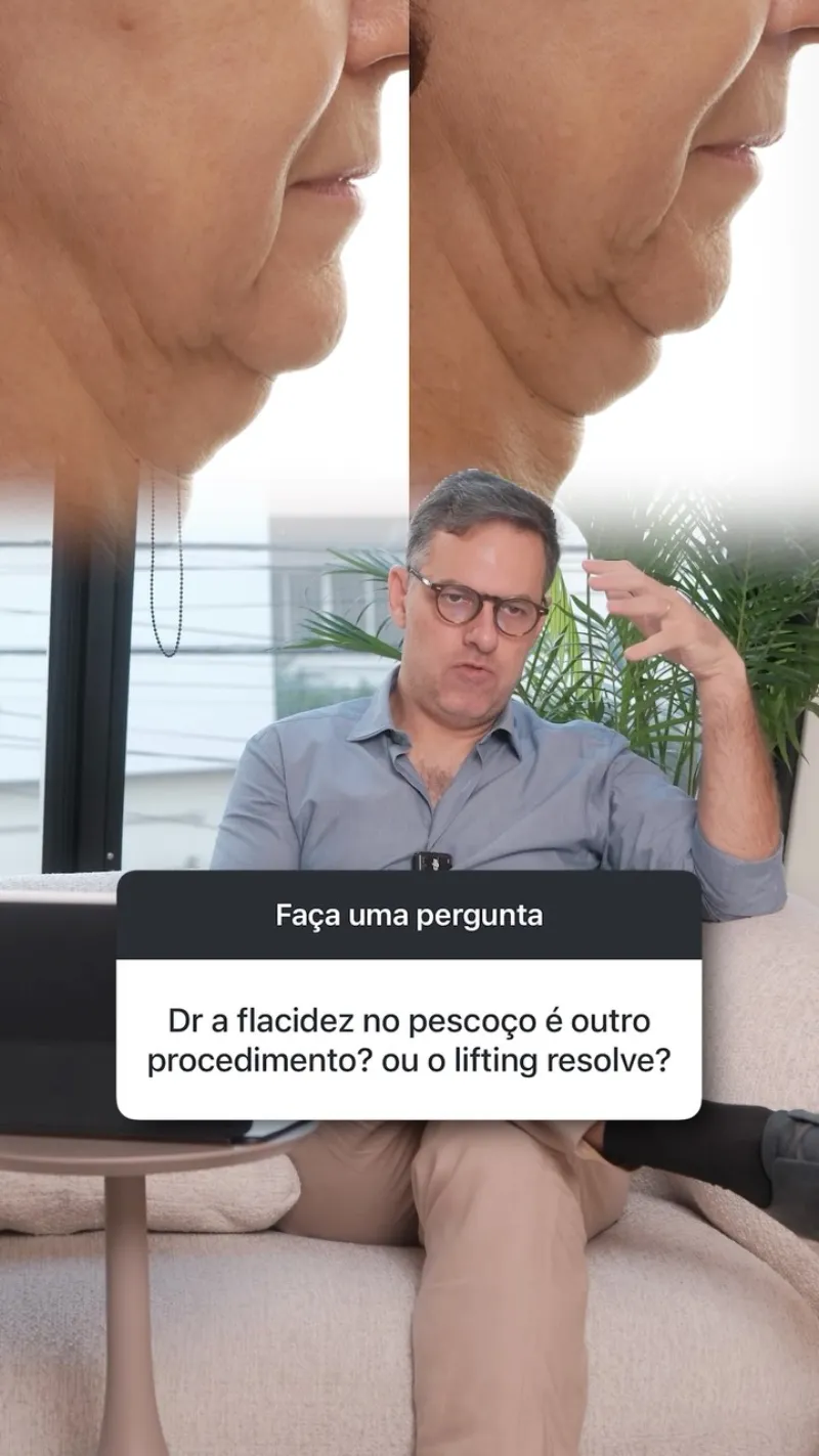 Before and after: Dr. Ricardo Kacowicz