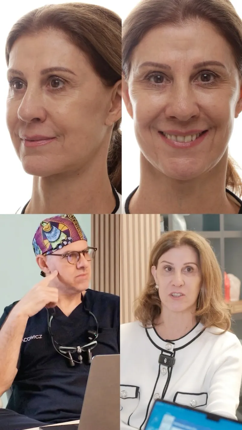 Before and after: Dr. Ricardo Kacowicz
