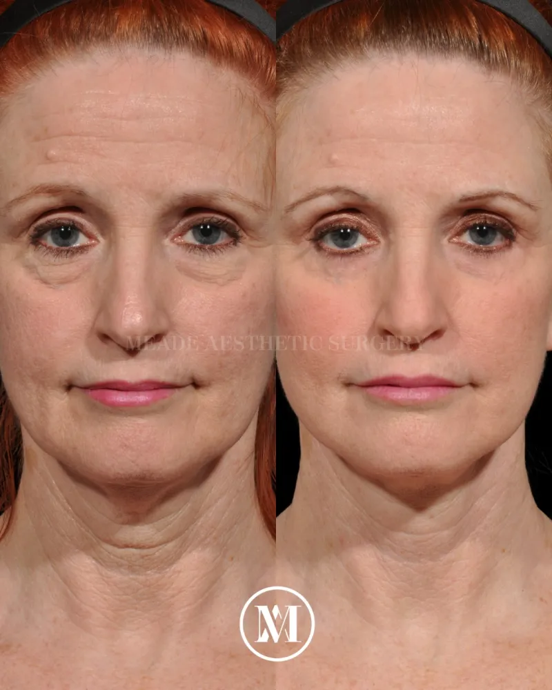 Before and after — Dr. Ricardo Meade