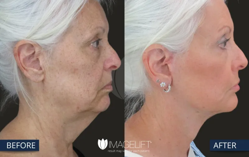 Before and after — Dr. Rich Castellano