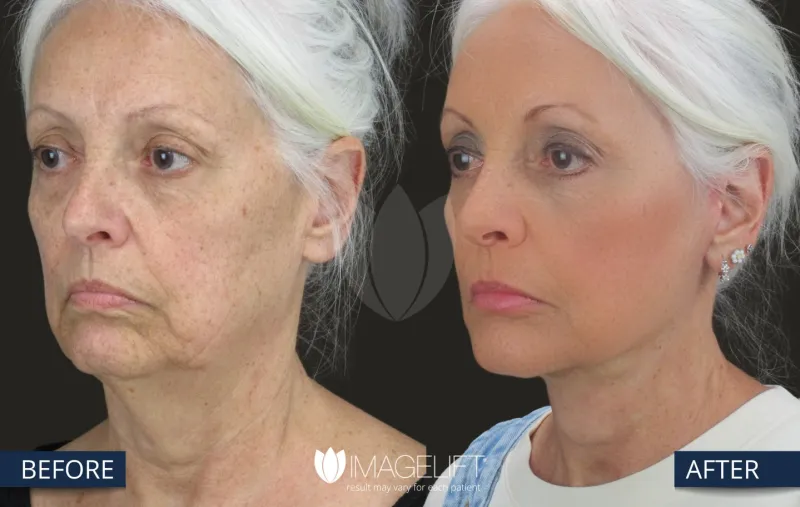 Before and after — Dr. Rich Castellano