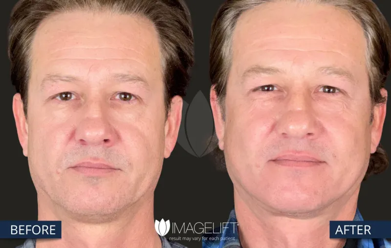 Before and after: Dr. Rich Castellano