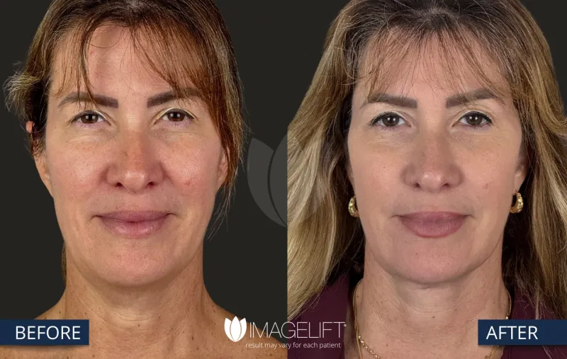 Before and after: Dr. Rich Castellano