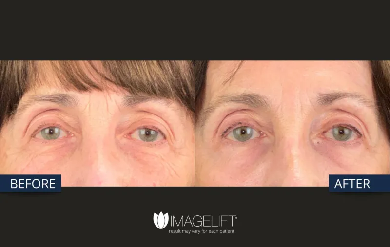 Before and after: Dr. Rich Castellano