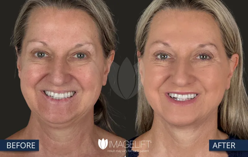 Before and after: Dr. Rich Castellano