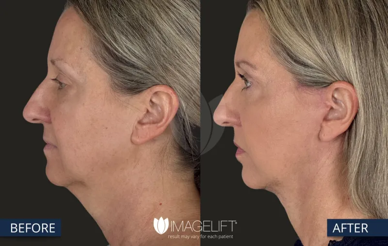 Before and after — Dr. Rich Castellano