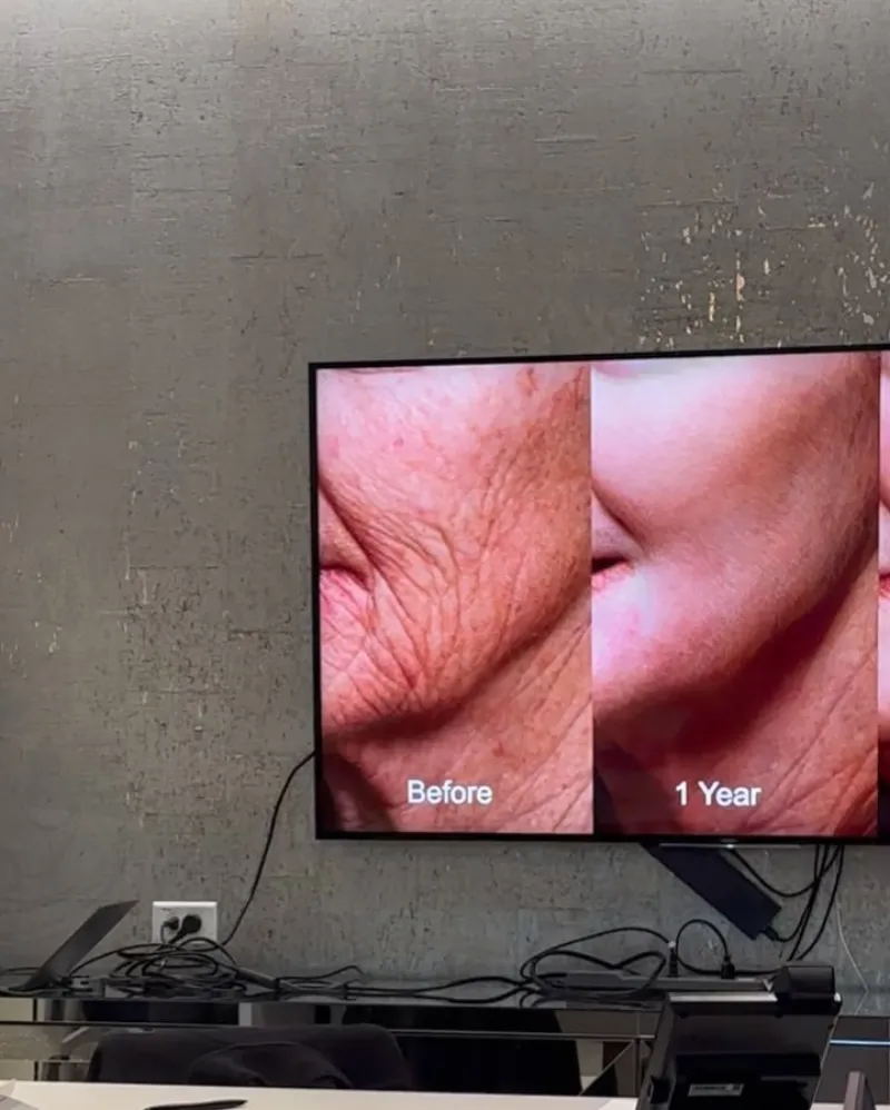 Before and after — Dr. Richard Bensimon