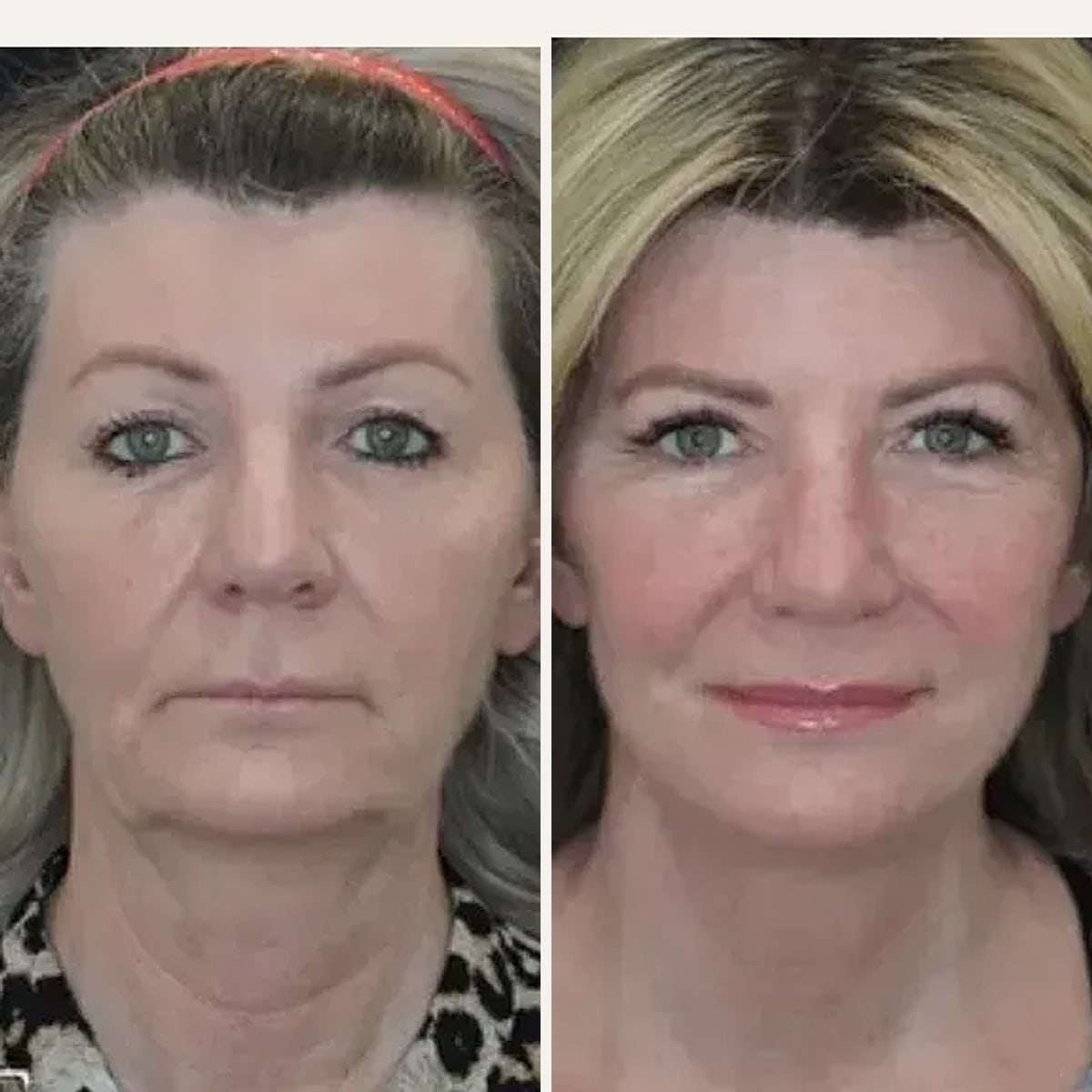 Before and after: Dr. Rick Jaggi