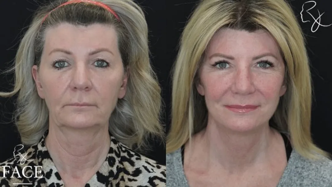 Before and after — Dr. Rick Jaggi