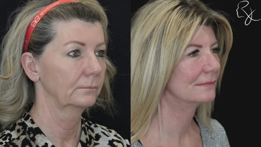 Before and after — Dr. Rick Jaggi