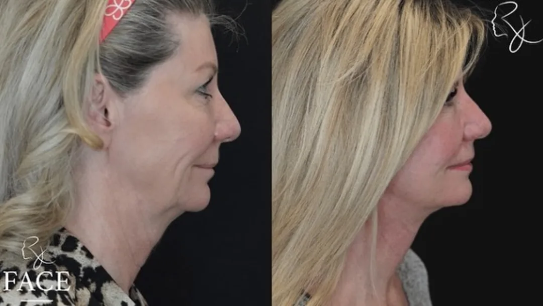 Before and after — Dr. Rick Jaggi