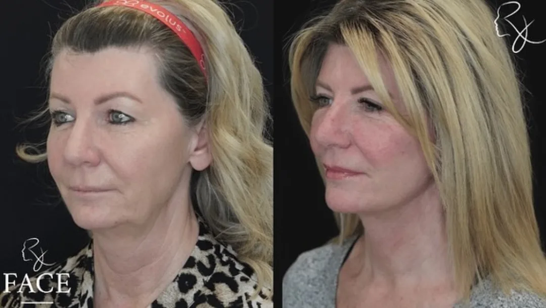 Before and after — Dr. Rick Jaggi