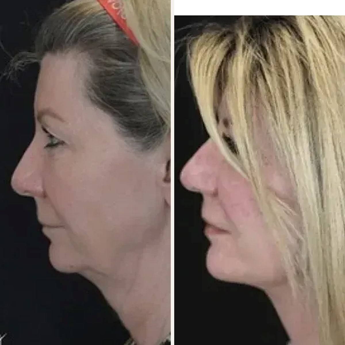 Before and after: Dr. Rick Jaggi
