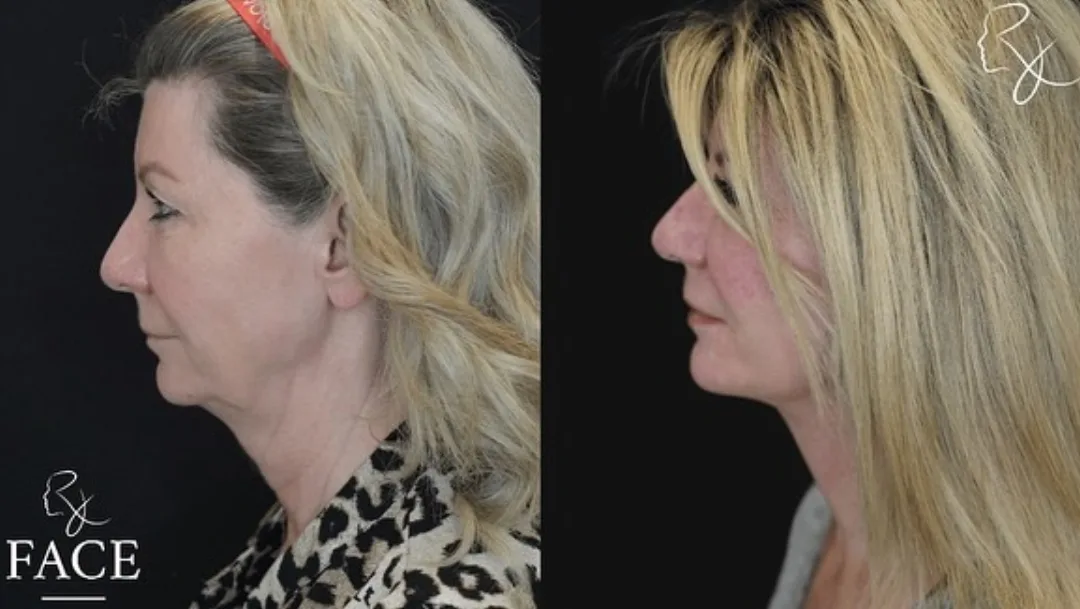 Before and after — Dr. Rick Jaggi
