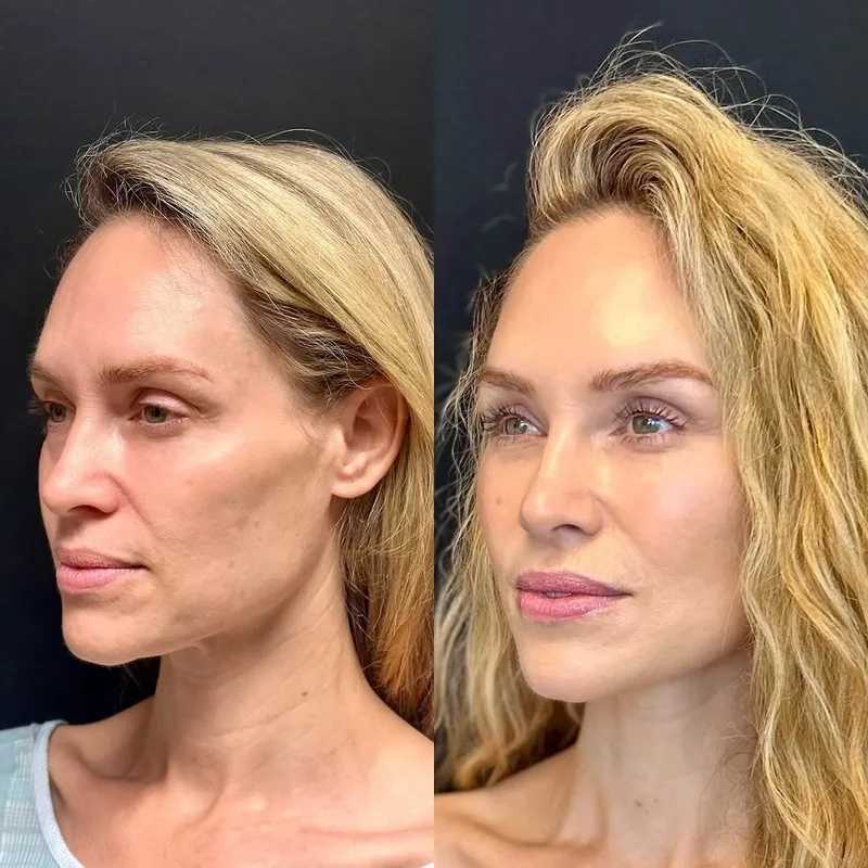 Before and after — Dr. Ritu Chopra