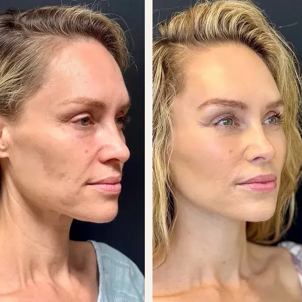 Before and after: Dr. Ritu Chopra