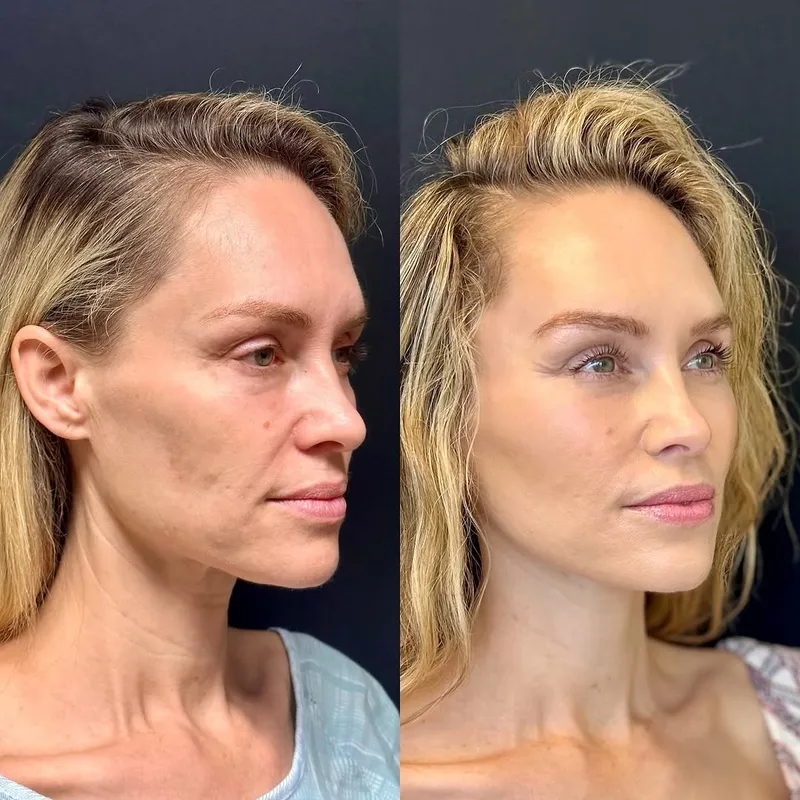 Before and after — Dr. Ritu Chopra