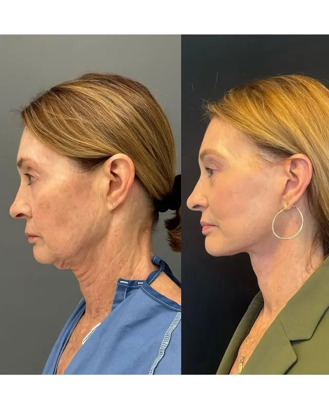 Before and after — Dr. Ritu Chopra