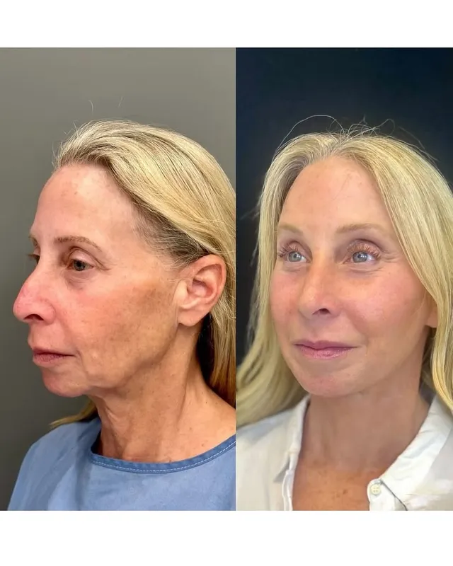 Before and after — Dr. Ritu Chopra
