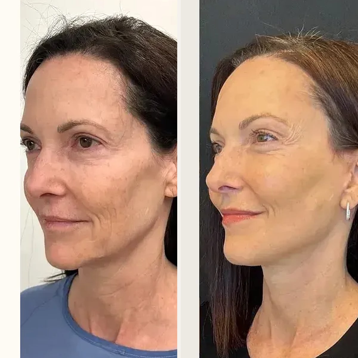 Before and after: Dr. Ritu Chopra