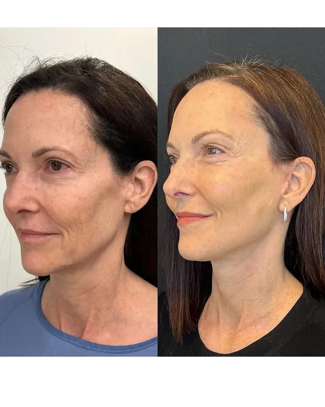 Before and after — Dr. Ritu Chopra