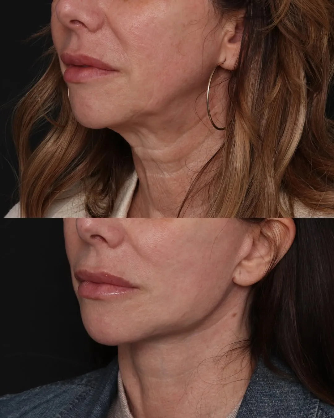 Before and after — Dr. Robert Glasgold