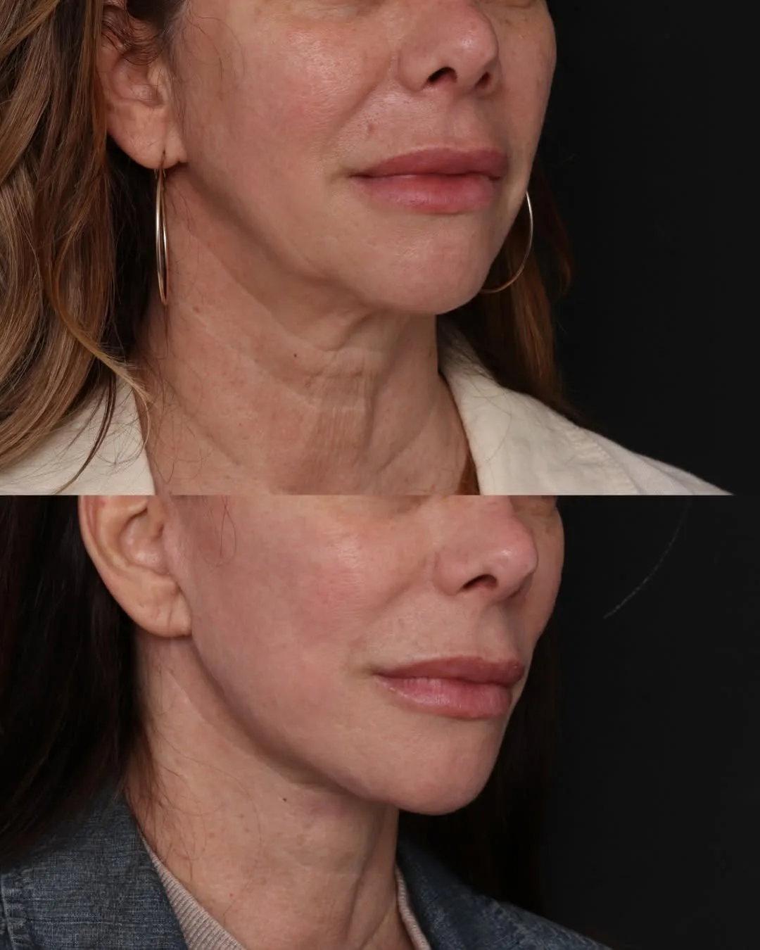 Before and after — Dr. Robert Glasgold