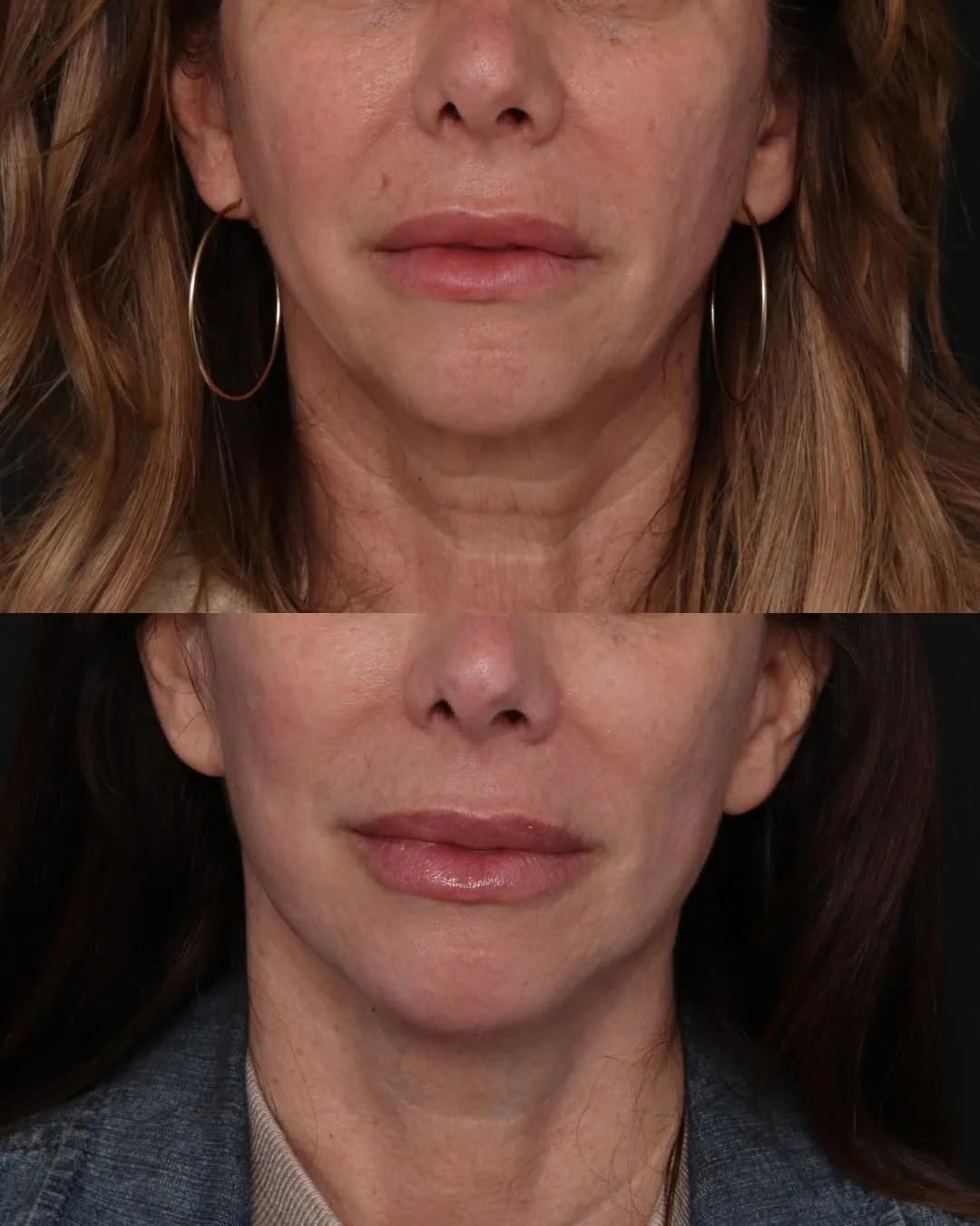 Before and after — Dr. Robert Glasgold