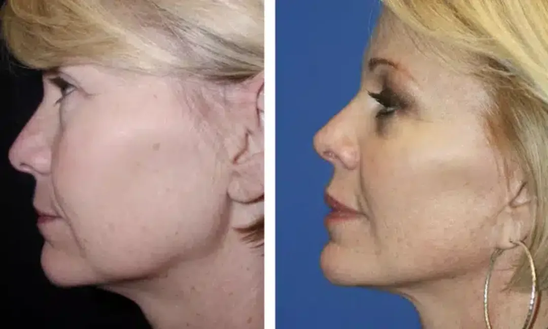 Before and after — Dr. Robert Troell