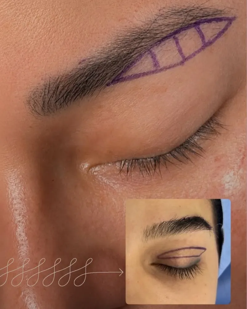 Before and after — Dr. Rogerio Leal