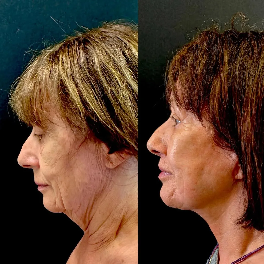 Before and after: Dr. Roman Kufa