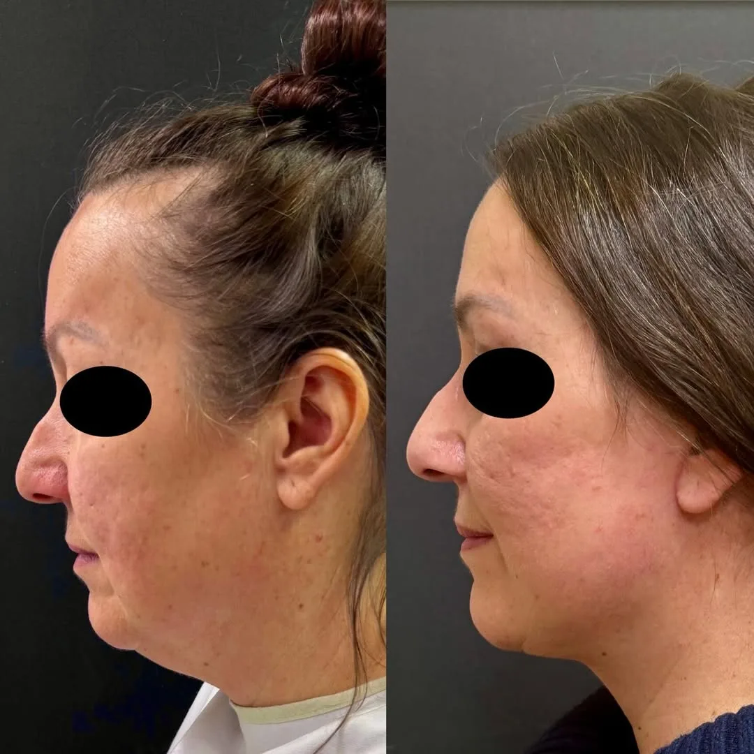 Before and after — Dr. Roman Kufa