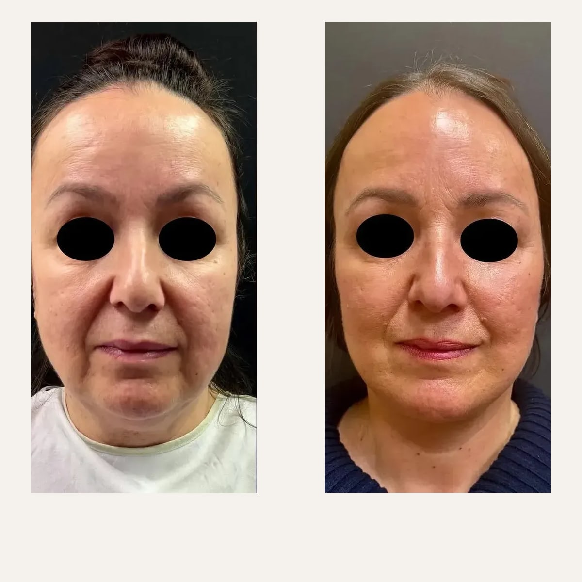 Before and after: Dr. Roman Kufa
