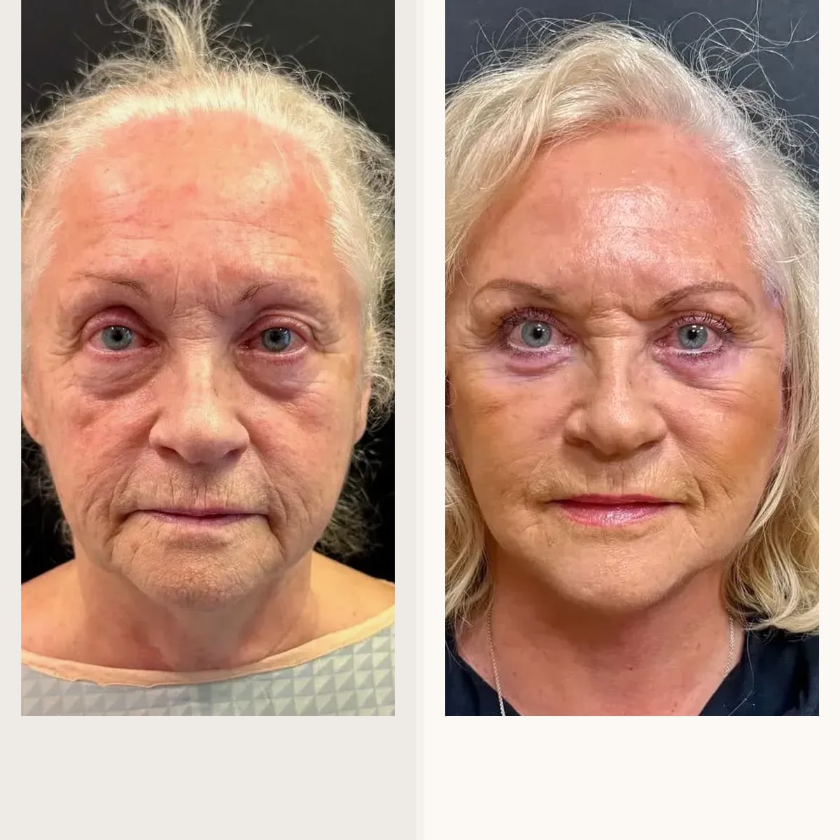 Before and after: Dr. Roman Kufa