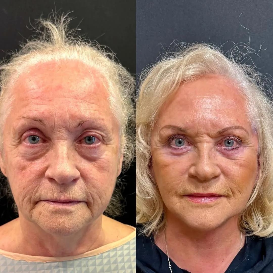 Before and after — Dr. Roman Kufa