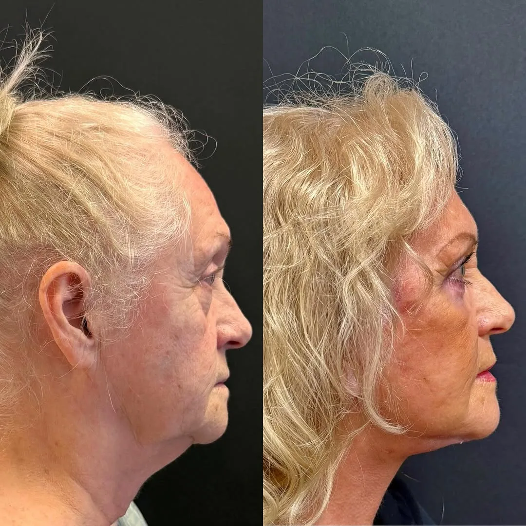 Before and after — Dr. Roman Kufa