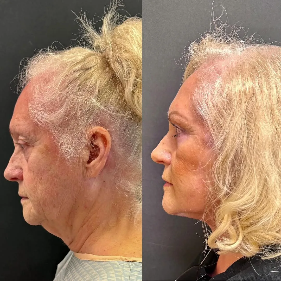 Before and after — Dr. Roman Kufa