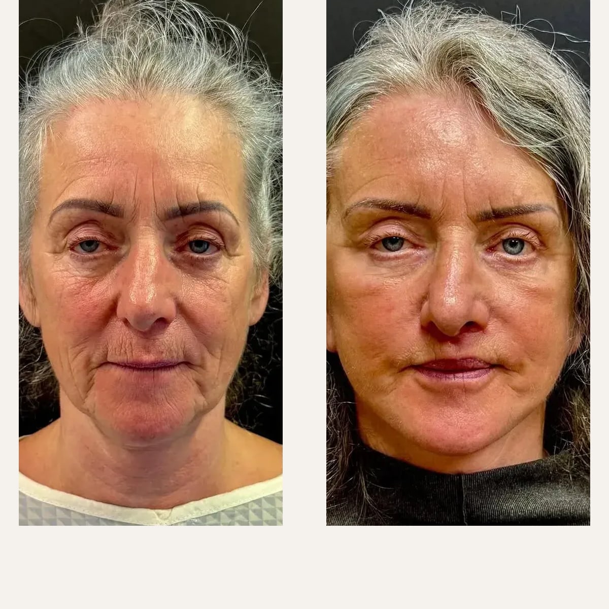Before and after: Dr. Roman Kufa
